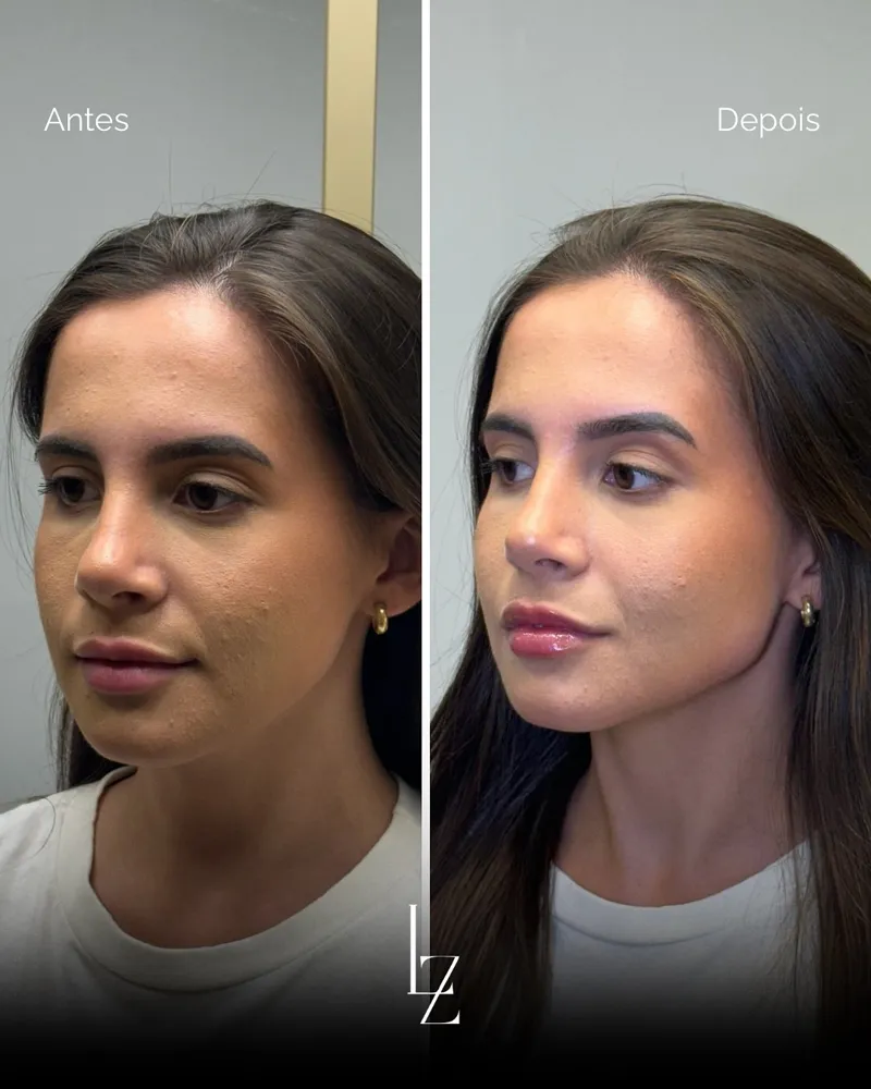 Resultado facial Dra. Luana