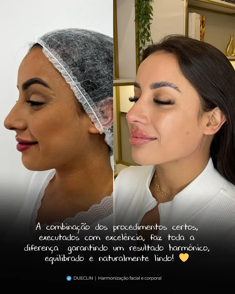 Resultado facial Dra. Luana