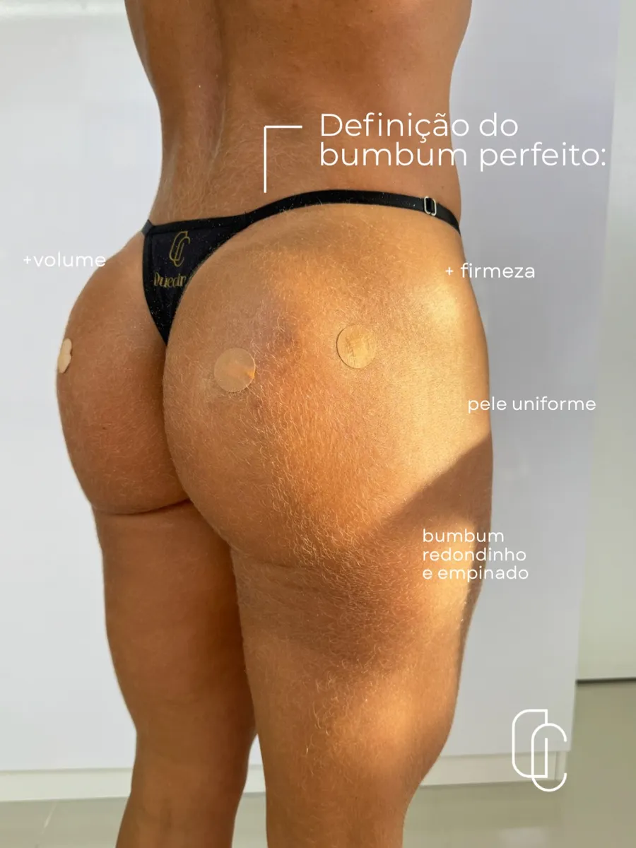 Resultado BumBoom Sculpt